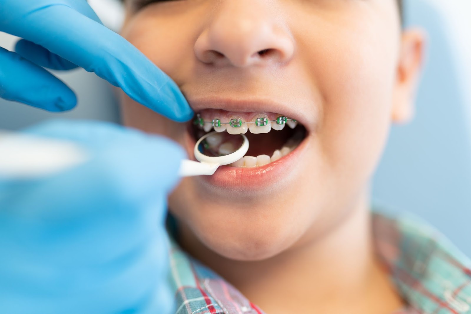 How Can Orthodontic Treatment Benefit My Child's Oral Health? 