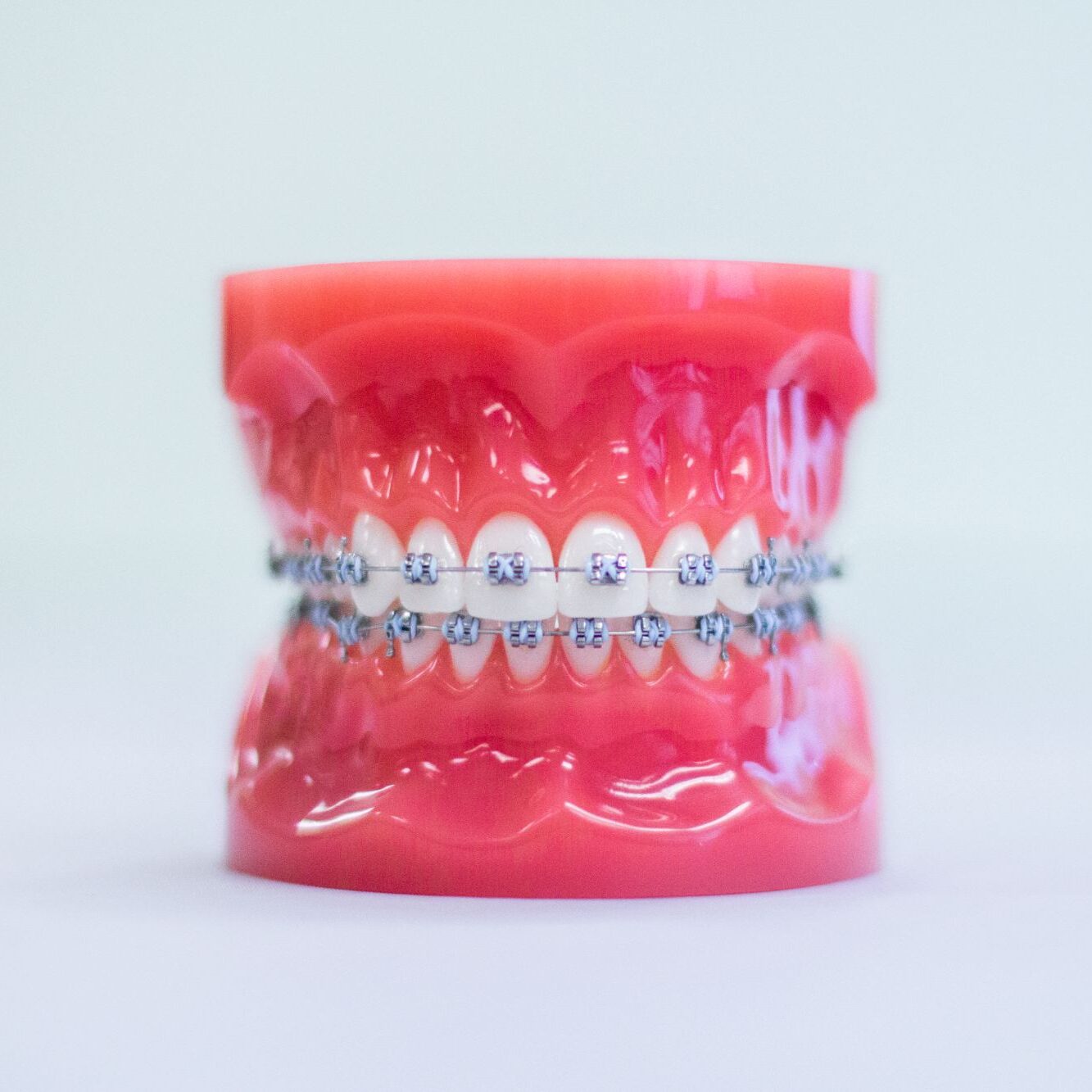 Metal Braces Palmetto Bay FL